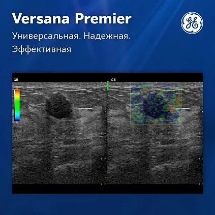 Клинические изображения Ультразвуковая система GE Versana Premier Platinum